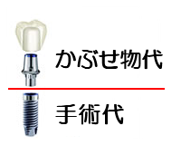 かぶせ物代 手術代